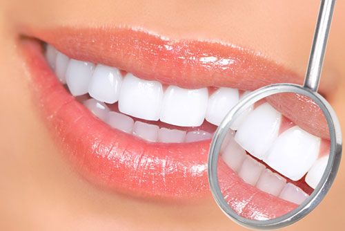 Dental whitening