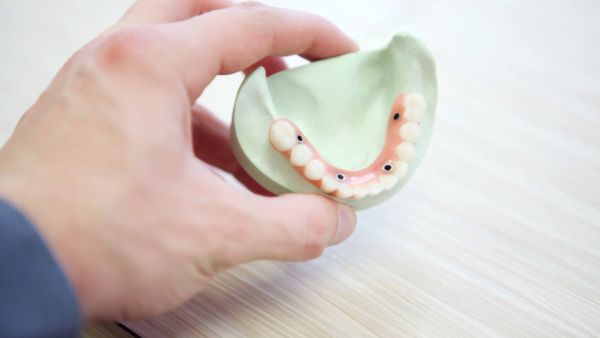 Ventajas de la prótesis dental híbrida